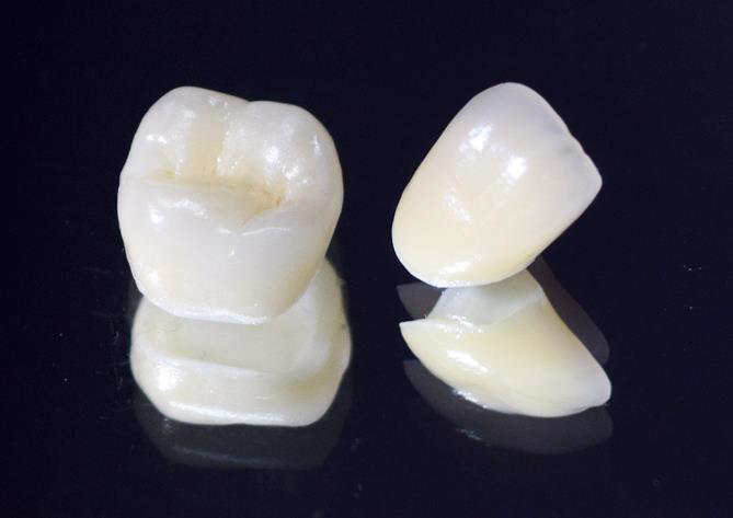 審美歯科治療 - 愛歯科クリニック｜八千代台・実籾の歯医者、愛歯科